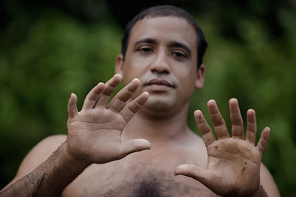 У 37-летнего Йоандри Эрнандеса Гарридо, в общей сложности, 24 пальца на руках и ногах, благодаря чему он получил лаконичное прозвище «Двадцать четыре»