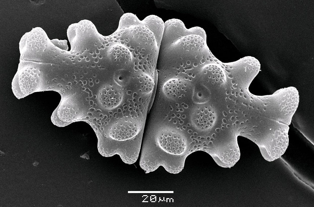 Клетка Euastrum pinnatum в сканирующем электронном микроскопе © Анисимова Ольга