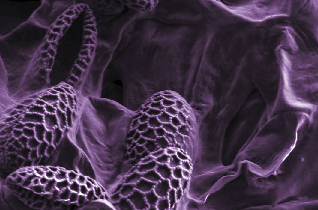 Микрофотография получена на микроскопе LeoSupra 50 VP. Увеличение 1000x © TiberiusRufus