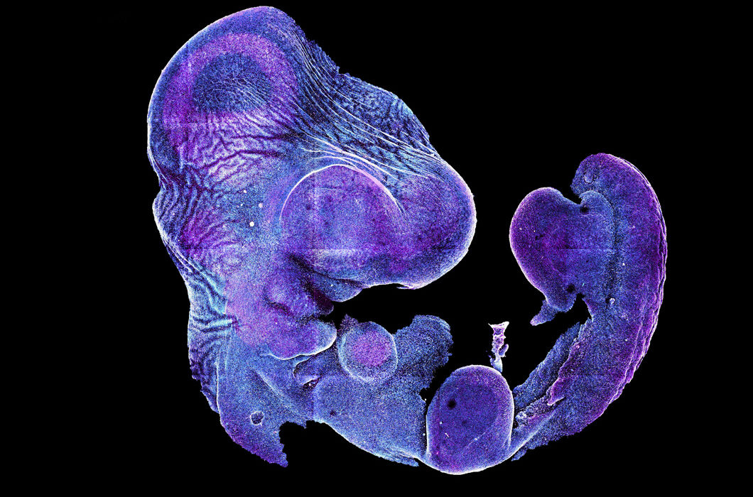 Куриный эмбрион возрастом четыре дня после оплодотворения. Конфокальная флуоресцентная микроскопия. Панорама из нескольких кадров © Hellblondinko